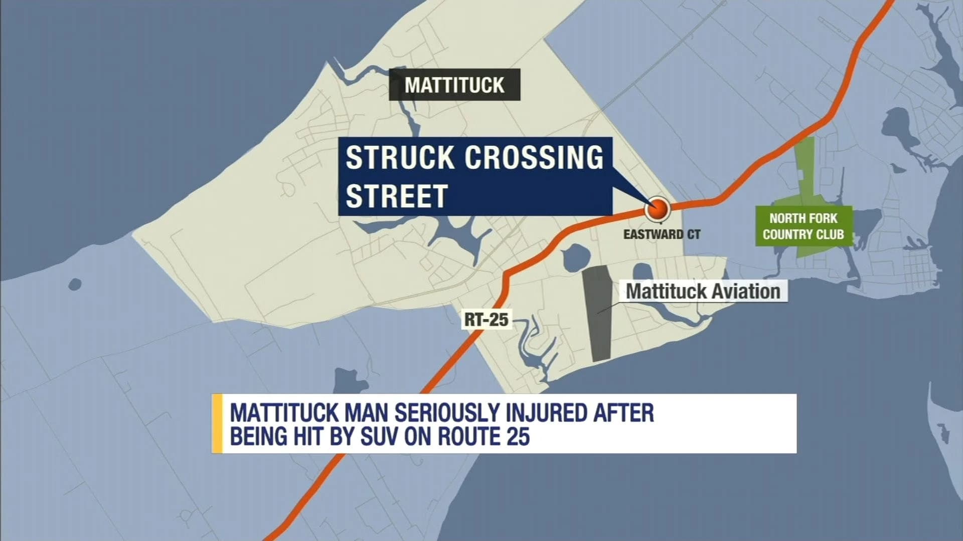 Man struck by car, injured in Mattituck