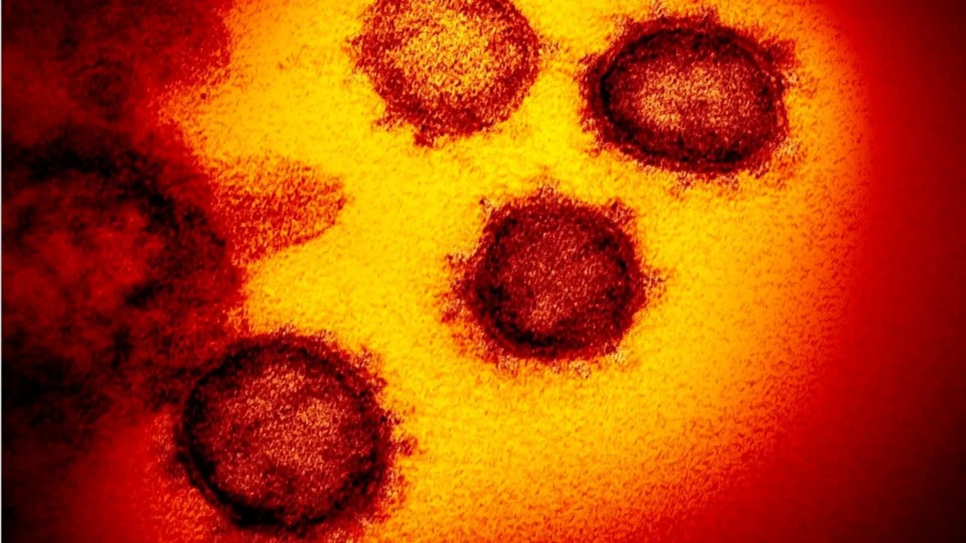 Los Angeles County reports virus death of person under 18