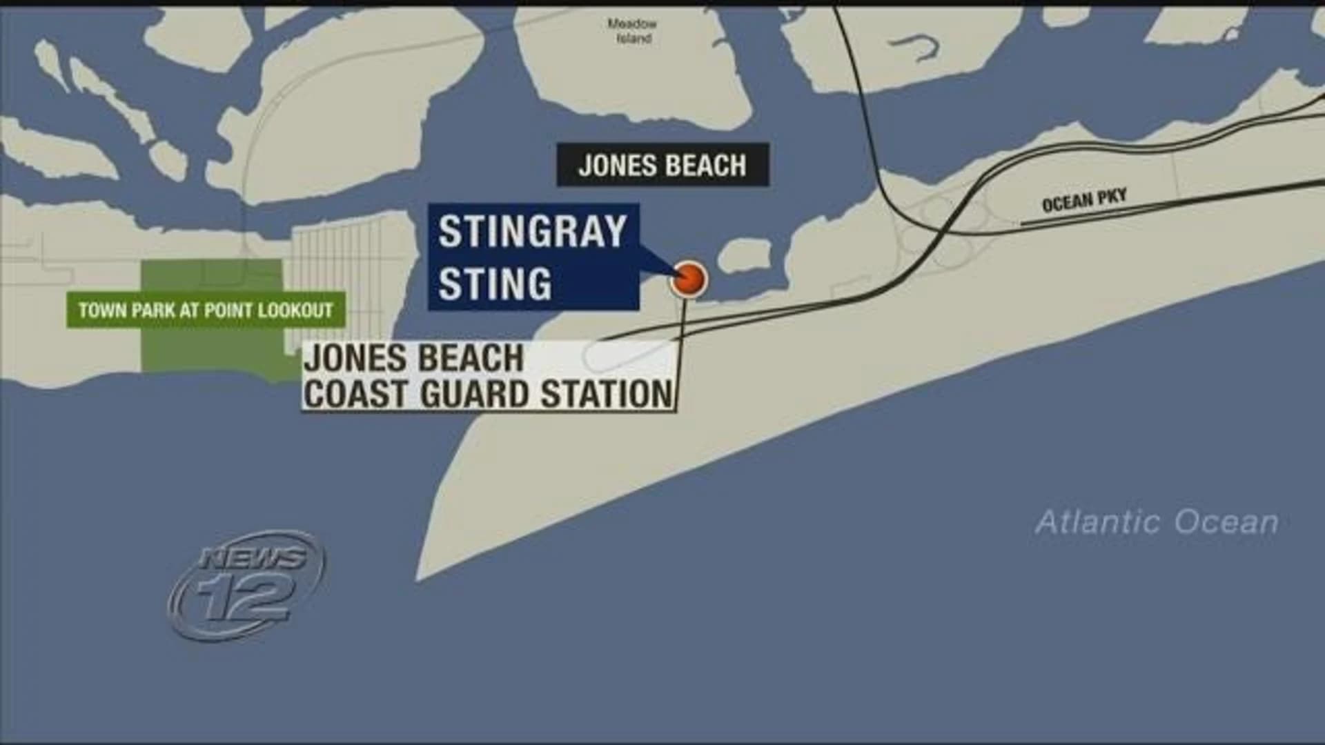 Beachgoer reports getting stung by sting ray at Jones Beach